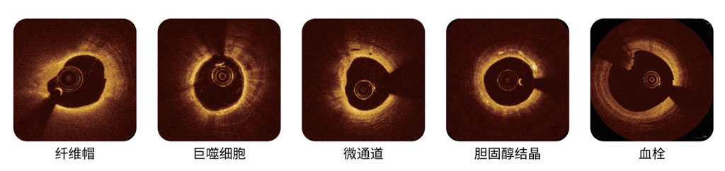 辨识动脉细微结构
